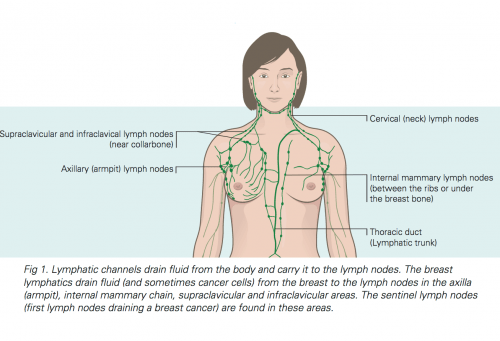 Lymphoedema fig 1