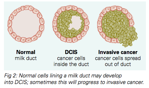 Ductal_fig2