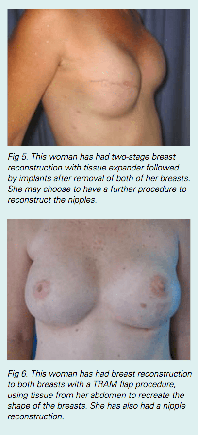 OvarianCancer_Figure3