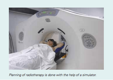 RadioTherapy-Figure1