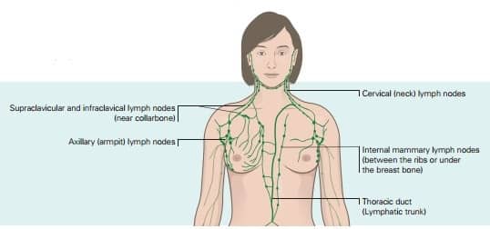 lymphoedema fig 1